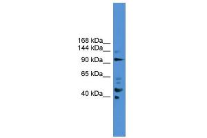 WB Suggested Anti-PIBF1 Antibody Titration: 0.
