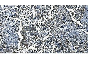 IHC analysis of PCBP2/hnRNP E2 using anti-PCBP2/hnRNP E2 antibody (ABIN7600449). (PCBP2 antibody  (AA 197-276))