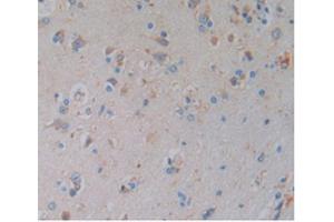 Detection of HO1 in Human Brain Tissue using Monoclonal Antibody to Heme Oxygenase 1 (HO1) (HMOX1 antibody  (AA 61-172))