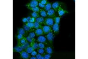 IF analysis of CLPP using anti-CLPP antibody (ABIN5693176). (CLPP antibody  (AA 184-247))