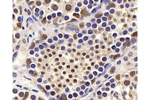 Immunohistochemistry analysis of paraffin-embedded mouse testis using BRAF Polyclonal Antibody at dilution of 1:400. (BRAF antibody)