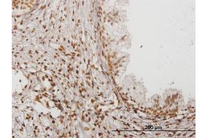 Immunoperoxidase of monoclonal antibody to IFI16 on formalin-fixed paraffin-embedded human prostate. (IFI16 antibody  (AA 630-729))