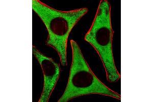 Fluorescent image of Hela cells stained with RPS6 Antibody (N-term) . (RPS6 antibody)
