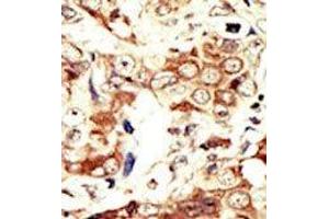 Image no. 2 for anti-Insulin Receptor-Related Receptor (INSRR) (C-Term) antibody (ABIN359889) (INSRR antibody  (C-Term))