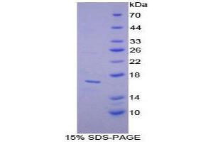 SDS-PAGE (SDS) image for Lactalbumin, alpha- (LALBA) (AA 24-141) protein (His tag) (ABIN2123990)