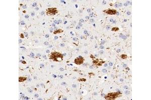 Immunohistochemistry analysis of paraffin-embedded rat brain using,PGS1 (ABIN7075039) at dilution of 1: 600 (PGS1 antibody)