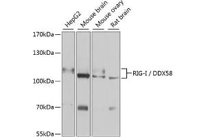 Western blot analysis of extracts of various cell lines, using Rig-I/DDX58 antibody (ABIN6130263, ABIN6139513, ABIN6139515 and ABIN6217394) at 1:1000 dilution. (DDX58 antibody  (AA 726-925))