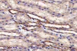 Immunohistochemistry analysis of paraffin-embedded rat kidney using,PSMD8 (ABIN7075226) at dilution of 1: 2600