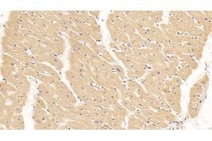 Detection of SLN in Human Cardiac Muscle Tissue using Polyclonal Antibody to Sarcolipin (SLN) (SLN antibody  (AA 1-31))