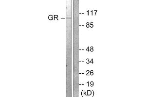 Western blot analysis of extracts from HeLa cells treated with PMA (125ng/ml, 30min), using GR (epitope around residue 211) antibody (ABIN5976159, Line 1 and 2). (GR (Internal Region), (pSer211) antibody)