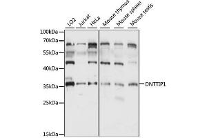 Western blot analysis of extracts of various cell lines, using DNTTIP1 antibody (ABIN6290313) at 1:1000 dilution. (DNTTIP1 antibody)