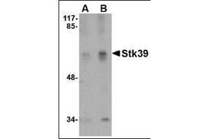 Western blot analysis of Stk39 in SK-N-SH cell lysate with this product at (A) 1 and (B) 2 μg/ml.