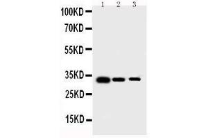 Anti-human Survivin antibody, Western blotting Lane 1: Recombinant Human Survivin Protein 10ng Lane 2: Recombinant Human Survivin Protein 5ng Lane 3: Recombinant Human Survivin Protein 2 (Survivin antibody  (AA 1-142))