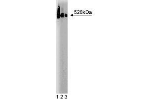 Western blot analysis of BRUCE on a SW-13 cell lysate (Human adrenal gland carcinoma, ATCC CCL-105). (BIRC6 antibody  (AA 372-571))