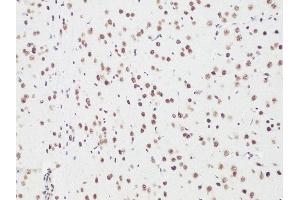 Immunohistochemistry of paraffin-embedded Rat brain using Bcl9 antibody (ABIN6129972, ABIN6137514, ABIN6137515 and ABIN6222543) at dilution of 1:100 (20x lens). (BCL9 antibody)