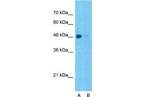 Host:  Rabbit  Target Name:  SPOP  Sample Type:  Hela  Lane A:  Primary Antibody  Lane B:  Primary Antibody + Blocking Peptide  Primary Antibody Concentration:  1ug/ml  Peptide Concentration:  5ug/ml  Lysate Quantity:  25ug/lane/lane  Gel Concentration:  0. (SPOP-B antibody  (C-Term))
