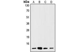 Western blot analysis of S100-A1 expression in HEK293T (A), mouse brain (B), rat brain (C), C6 (D) whole cell lysates. (S100A1 antibody  (N-Term))