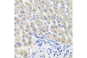 Immunohistochemistry of paraffin-embedded human liver injury using HSD11B2 antibody (ABIN5995471) at dilution of 1/100 (40x lens). (HSD11B2 antibody)