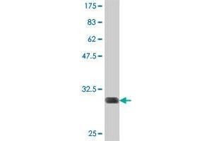 Western Blot detection against Immunogen (31.