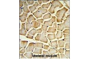 Formalin-fixed and paraffin-embedded human skeletal muscle reacted with PIK4CB Antibody (Center), which was peroxidase-conjugated to the secondary antibody, followed by DAB staining. (PI4KB antibody  (AA 519-548))