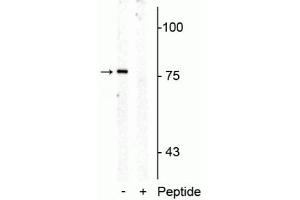 Western blot of rat mid brain membrane lysate showing specific immunolabeling of the ~76 kDa SERT protein phosphorylated at Thr276 in the first lane (-). (SLC6A4 antibody  (pThr276))