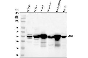 anti-Adenosine Deaminase (ADA) (AA 2-241) antibody