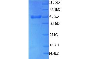 SDS-PAGE (SDS) image for Thrombopoietin (THPO) (AA 22-194), (partial) protein (GST tag) (ABIN5712542)