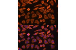Immunofluorescence analysis of L929 cells using GUCY1 Rabbit pAb (ABIN6127969, ABIN6141533, ABIN6141534 and ABIN6216446) at dilution of 1:100 (40x lens). (GUCY1A1 antibody  (AA 1-120))
