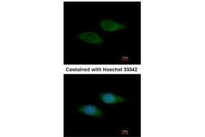 ICC/IF Image Immunofluorescence analysis of methanol-fixed HeLa, using SNTB2, antibody at 1:200 dilution. (SNTB2 antibody)