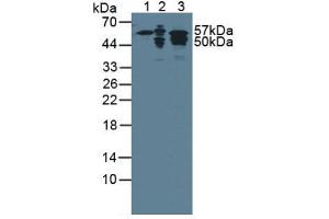 Figure. (Cytokeratin 7 antibody  (AA 91-394))