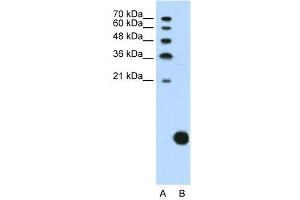 WB Suggested Anti-RPS29  Antibody Titration: 1. (RPS29 antibody  (N-Term))