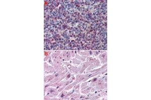 Immunohistochemistry (Formalin/PFA-fixed paraffin-embedded sections) of human spleen (A) and human heart tissue (B) with CYSLTR2 polyclonal antibody . (CasLTR2 antibody  (Extracellular Domain))