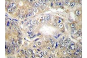 Image no. 1 for anti-Tumor Necrosis Factor (Ligand) Superfamily, Member 13 (TNFSF13) antibody (ABIN272145) (TNFSF13 antibody)