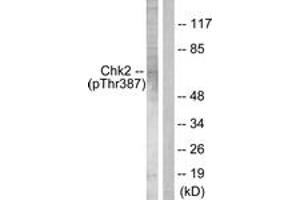 Western blot analysis of extracts from Jurkat cells, using Chk2 (Phospho-Thr387) Antibody. (CHEK2 antibody  (pThr387))
