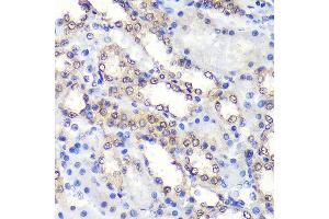 Immunohistochemistry of paraffin-embedded Rat kidney using PSME4 Rabbit pAb  at dilution of 1:100 (40x lens). (PSME4 antibody  (AA 1634-1843))