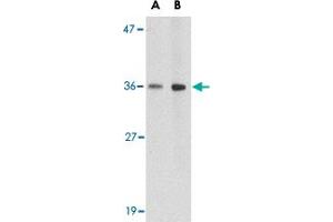 Western blot analysis of HAPLN2 in human brain tissue lysate with HAPLN2 polyclonal antibody  at (A) 1 and (B) 2 ug/mL .