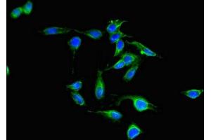 Immunofluorescent analysis of Hela cells using ABIN7169128 at dilution of 1:100 and Alexa Fluor 488-congugated AffiniPure Goat Anti-Rabbit IgG(H+L) (PAK3 antibody  (AA 70-190))