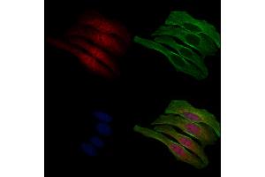 ABIN6265176 and ABIN6268795 staining Hela cells by IF/ICC.