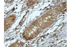 Immunohistochemistry (IHC) image for anti-Phosphatidic Acid Phosphatase Type 2 Domain Containing 1A (PPAPDC1A) (AA 89-149) antibody (ABIN1856403) (PPAPDC1A antibody  (AA 89-149))