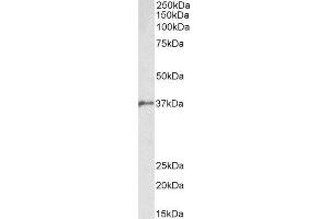 ABIN4902554 (2µg/ml) staining of Pig Bone Marrow lysate (35µg protein in RIPA buffer). (BMI1 antibody)