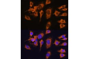 Immunofluorescence analysis of C6 cells using SLC20 antibody (ABIN1682754, ABIN3018562, ABIN3018563 and ABIN6220499) at dilution of 1:100.