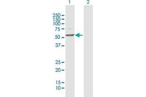 Western Blot analysis of TBL1X expression in transfected 293T cell line by TBL1X MaxPab polyclonal antibody. (TBL1X antibody  (AA 1-526))