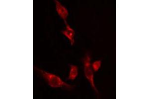ABIN6274526 staining 293 cells by IF/ICC. (Ethanolamine Kinase 2 antibody  (Internal Region))