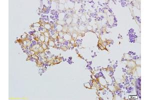 Formalin-fixed and paraffin embedded rat bone marrow labeled with Anti-SLC44A1/CD92 Polyclonal Antibody, Unconjugated (ABIN702370) at 1:200 followed by conjugation to the secondary antibody and DAB staining (SLC44A1 antibody  (AA 81-180))