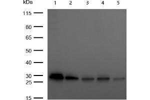 All lanes : C1QBP Rabbit mAb at 1/1k dilution Lane 1 : 293T whole cell lysates Lane 2 : A549 whole cell lysates Lane 3 : Hela whole cell lysates Lane 4 : HepG2 whole cell lysates Lane 5 : C2C12 whole cell lysates Lysates/proteins at 20 μg per lane. (Recombinant C1QBP antibody)