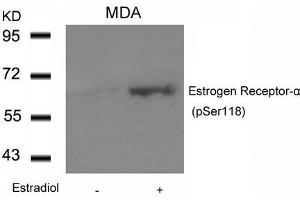 Western blot analysis of extracts from MDA cells untreated or treated with Estradiol using Estrogen Receptor-a(Phospho-Ser118) Antibody. (Estrogen Receptor alpha antibody  (pSer118))