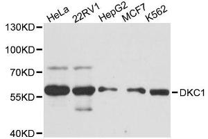 Western blot analysis of extracts of various cell lines, using DKC1 antibody. (DKC1 antibody  (AA 1-180))