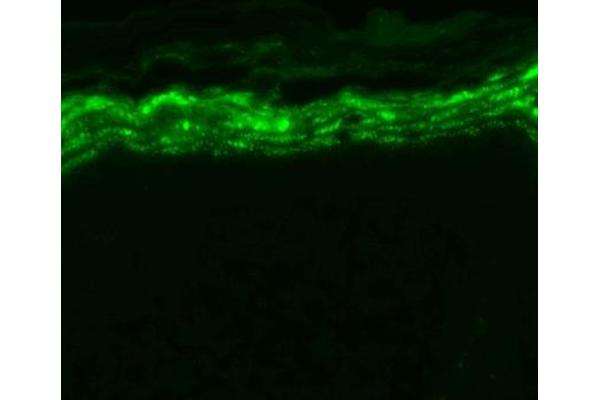 SCN9A antibody  (AA 1751-1946) (HRP)