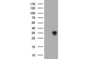 HEK293T cells were transfected with the pCMV6-ENTRY control (Left lane) or pCMV6-ENTRY ACY3 (Right lane) cDNA for 48 hrs and lysed. (Aminoacylase 3 antibody)