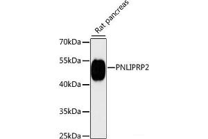 Western blot analysis of extracts of Rat pancreas using PNLIPRP2 Polyclonal Antibody at dilution of 1:3000. (PNLIPRP2 antibody)